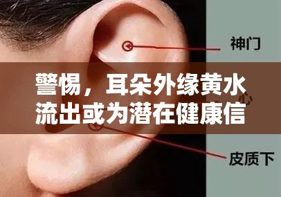 警惕，耳朵外緣黃水流出或?yàn)闈撛诮】敌盘? class=