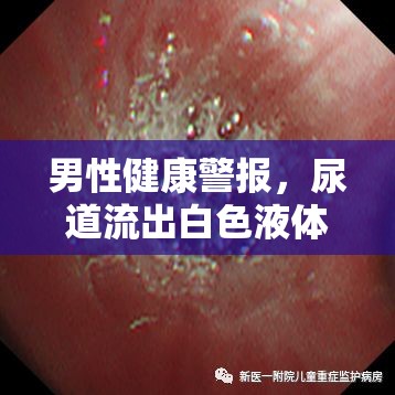 男性健康警報，尿道流出白色液體，背后的真相你該知道