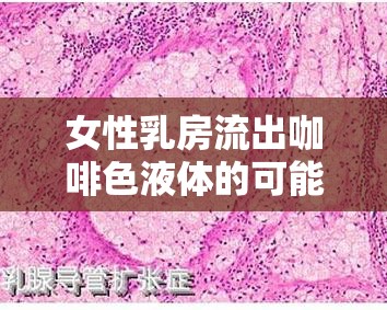 女性乳房流出咖啡色液體的可能原因與健康風險