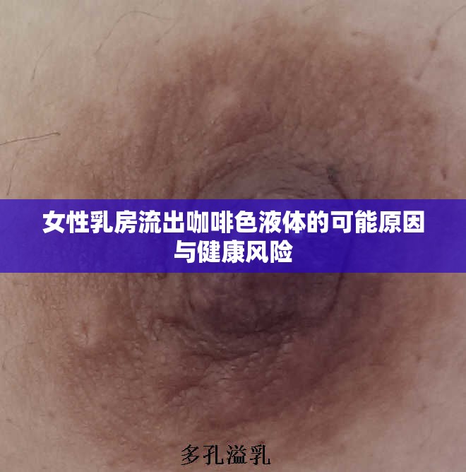 女性乳房流出咖啡色液體的可能原因與健康風險