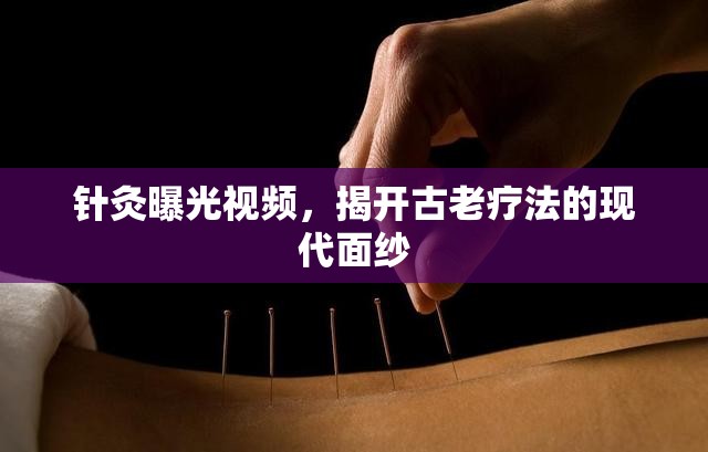 針灸曝光視頻，揭開(kāi)古老療法的現(xiàn)代面紗