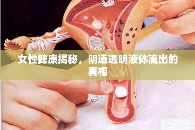 女性健康揭秘，陰道透明液體流出的真相