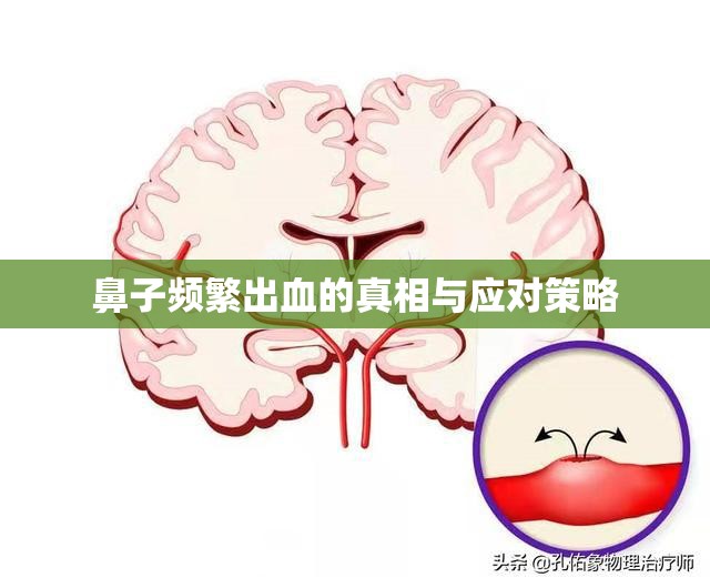 鼻子頻繁出血的真相與應(yīng)對策略