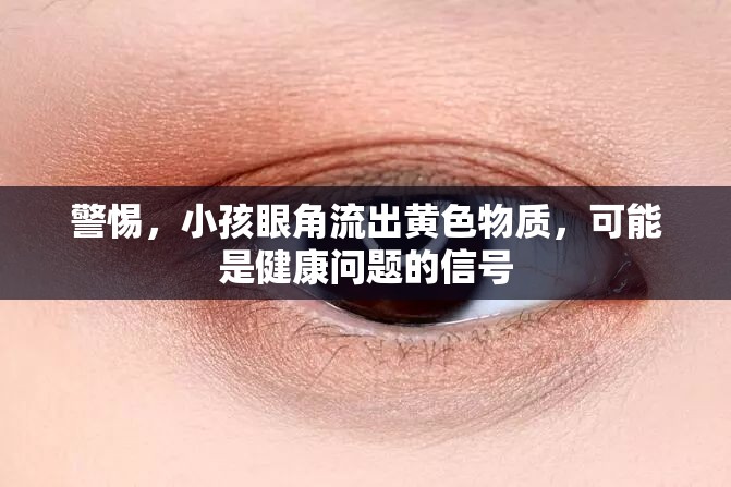 警惕，小孩眼角流出黃色物質(zhì)，可能是健康問題的信號