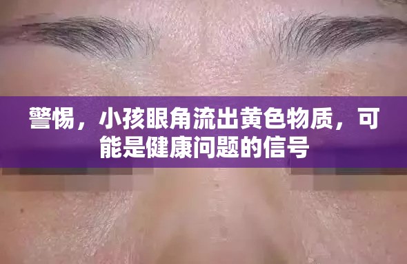警惕，小孩眼角流出黃色物質(zhì)，可能是健康問題的信號