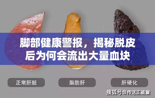 腳部健康警報(bào)，揭秘脫皮后為何會(huì)流出大量血塊