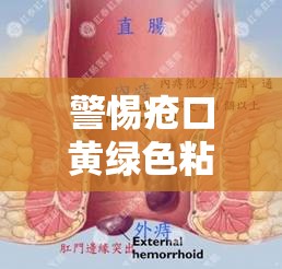 警惕瘡口黃綠色粘液，解讀背后的健康警報