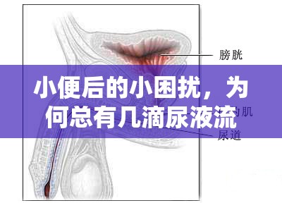 小便后的小困擾，為何總有幾滴尿液流出來？