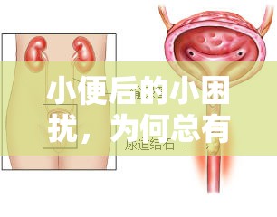 小便后的小困擾，為何總有幾滴尿液流出來？