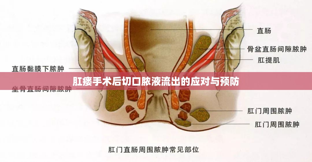 肛瘺手術(shù)后切口膿液流出的應(yīng)對與預(yù)防