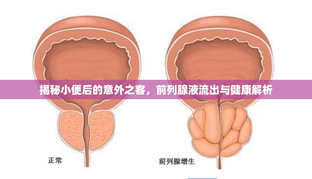 揭秘小便后的意外之客，前列腺液流出與健康解析