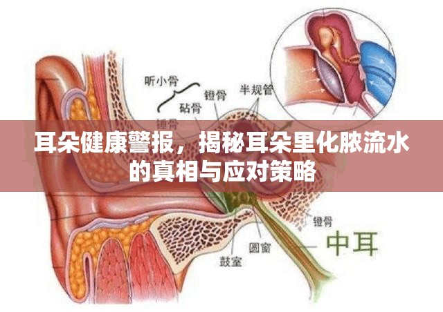 耳朵健康警報，揭秘耳朵里化膿流水的真相與應對策略