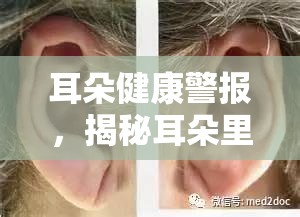 耳朵健康警報，揭秘耳朵里化膿流水的真相與應對策略