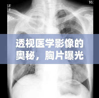 透視醫(yī)學影像的奧秘，胸片曝光方式詳解