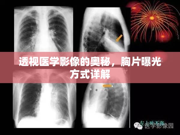 透視醫(yī)學影像的奧秘，胸片曝光方式詳解