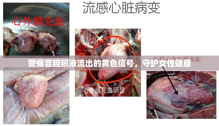 警惕宮腔積液流出的黃色信號，守護女性健康