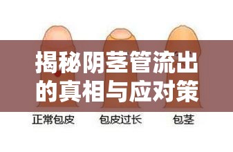 揭秘陰莖管流出的真相與應(yīng)對策略