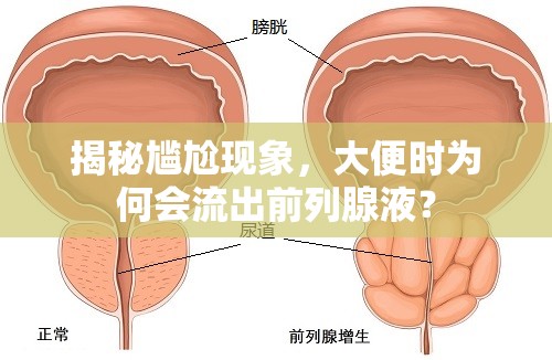 揭秘尷尬現(xiàn)象，大便時(shí)為何會(huì)流出前列腺液？