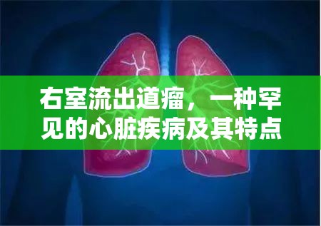 右室流出道瘤，一種罕見的心臟疾病及其特點(diǎn)