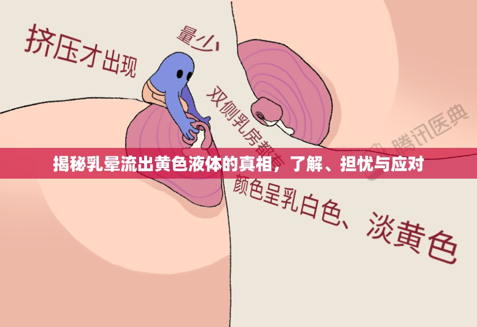 揭秘乳暈流出黃色液體的真相，了解、擔憂與應對
