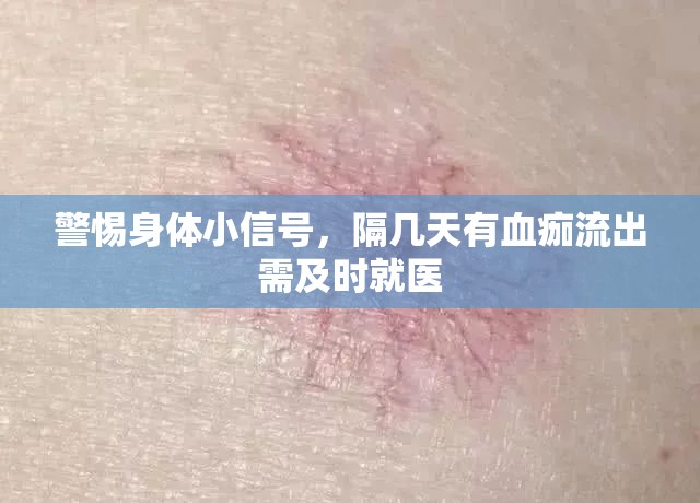 警惕身體小信號(hào)，隔幾天有血痂流出需及時(shí)就醫(yī)
