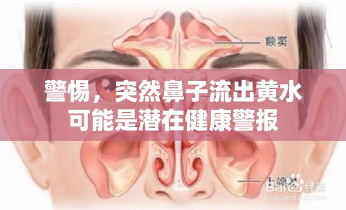 警惕，突然鼻子流出黃水可能是潛在健康警報(bào)