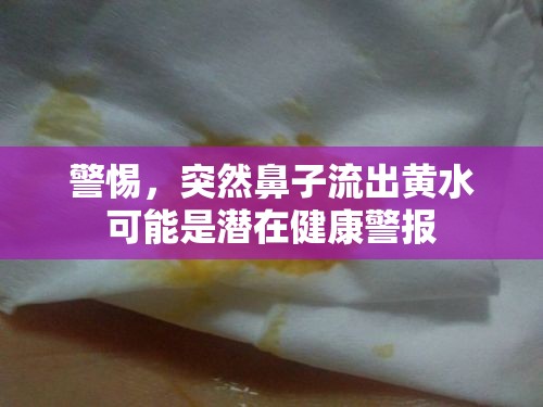 警惕，突然鼻子流出黃水可能是潛在健康警報(bào)