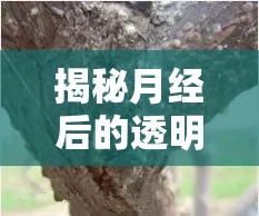 揭秘月經(jīng)后的透明液體，那幾天的生理現(xiàn)象與解讀