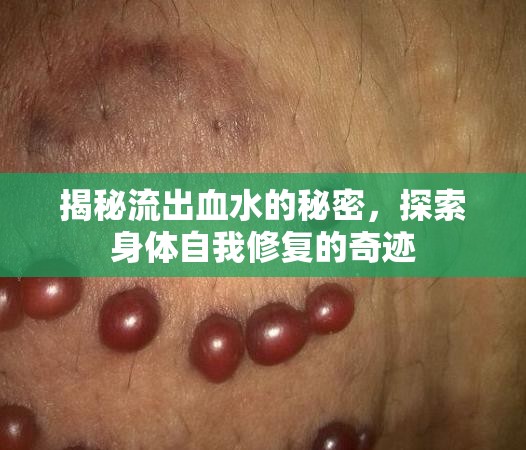 揭秘流出血水的秘密，探索身體自我修復的奇跡