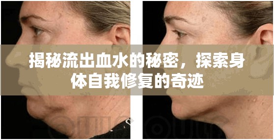 揭秘流出血水的秘密，探索身體自我修復的奇跡