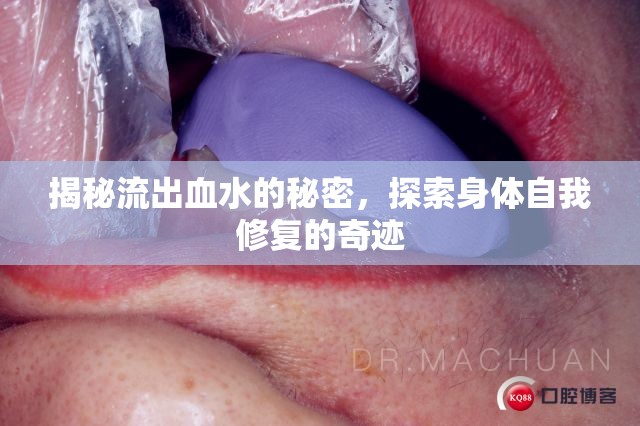揭秘流出血水的秘密，探索身體自我修復的奇跡