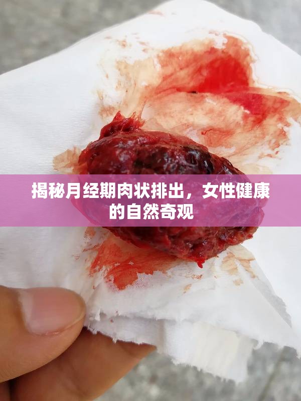 揭秘月經(jīng)期肉狀排出，女性健康的自然奇觀