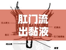 肛門流出黏液，了解癥狀、原因與應(yīng)對(duì)策略
