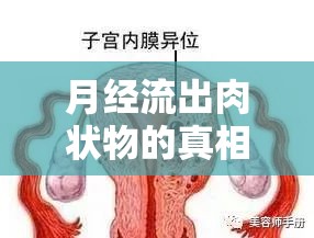 月經(jīng)流出肉狀物的真相，生理奇觀與健康守護(hù)的對話