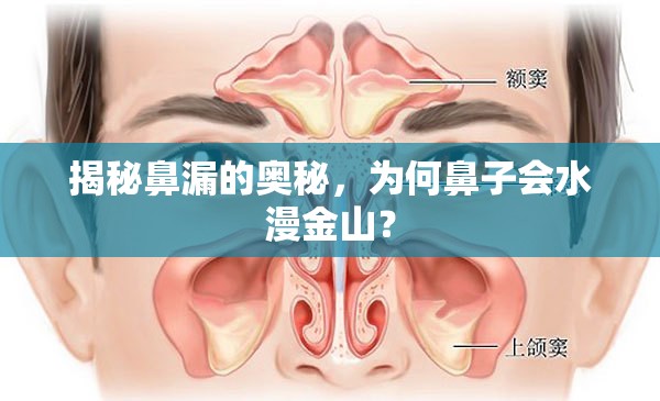 揭秘鼻漏的奧秘，為何鼻子會(huì)水漫金山？