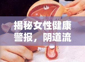 揭秘女性健康警報，陰道流出黃色異味背后的真相