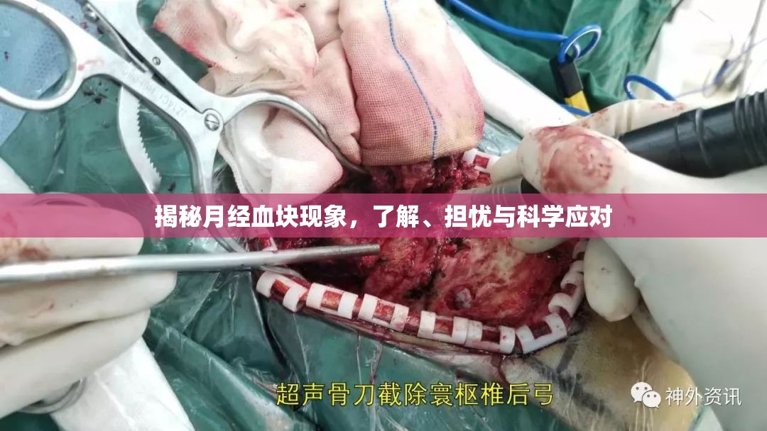 揭秘月經(jīng)血塊現(xiàn)象，了解、擔(dān)憂與科學(xué)應(yīng)對
