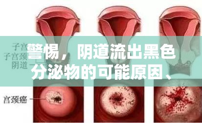警惕，陰道流出黑色分泌物的可能原因、癥狀與應對策略