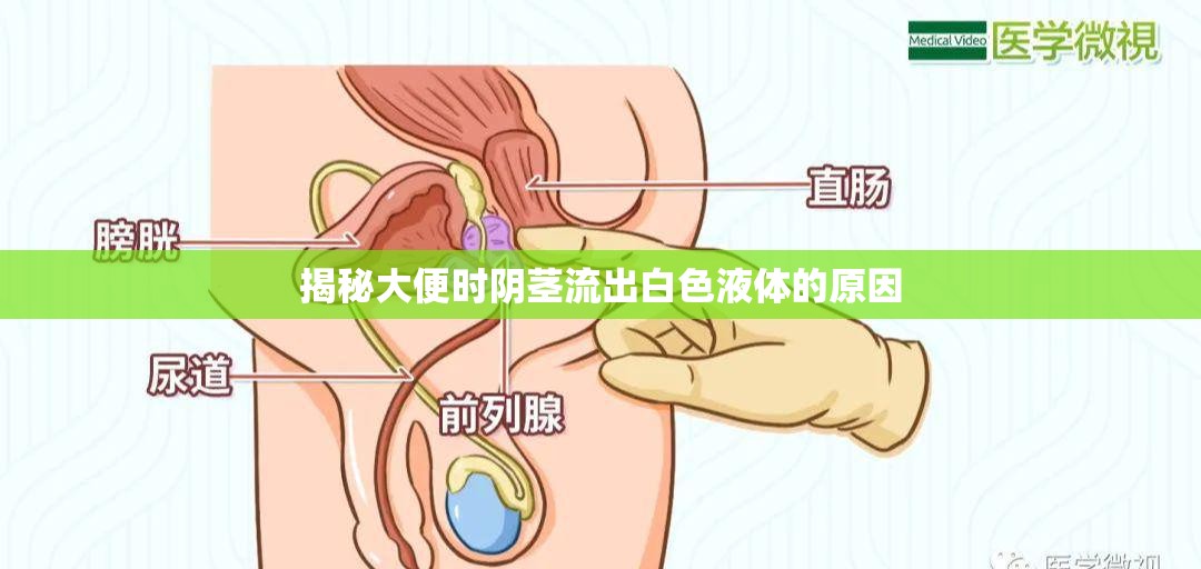 揭秘大便時(shí)陰莖流出白色液體的原因