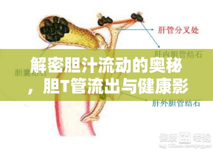 解密膽汁流動(dòng)的奧秘，膽T管流出與健康影響