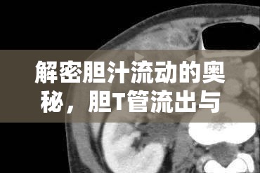 解密膽汁流動(dòng)的奧秘，膽T管流出與健康影響
