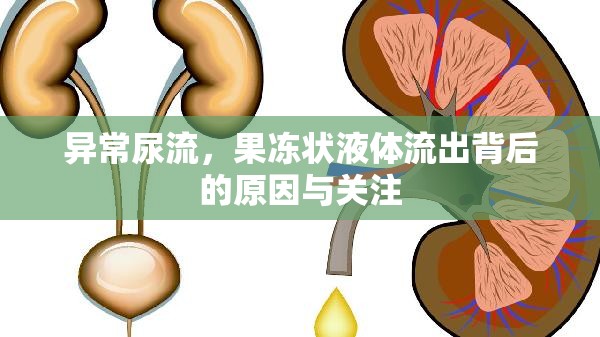 異常尿流，果凍狀液體流出背后的原因與關(guān)注