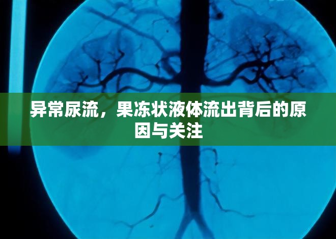 異常尿流，果凍狀液體流出背后的原因與關(guān)注