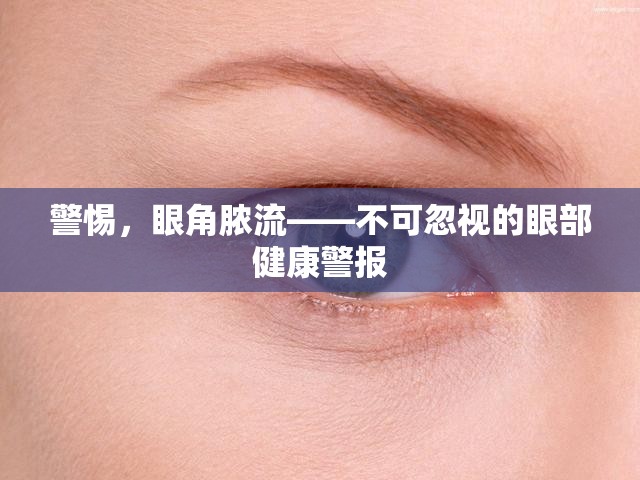 警惕，眼角膿流——不可忽視的眼部健康警報(bào)