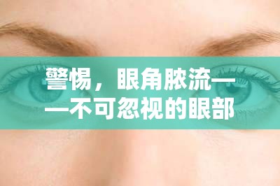 警惕，眼角膿流——不可忽視的眼部健康警報(bào)