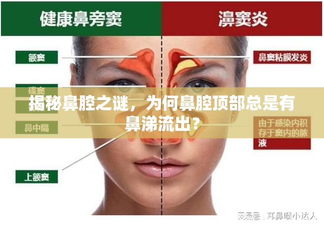 揭秘鼻腔之謎，為何鼻腔頂部總是有鼻涕流出？