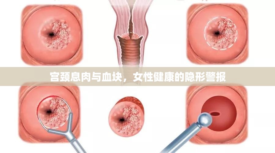 宮頸息肉與血塊，女性健康的隱形警報