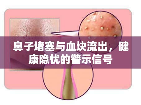 鼻子堵塞與血塊流出，健康隱憂的警示信號