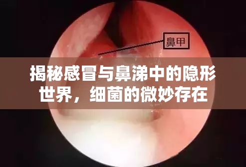 揭秘感冒與鼻涕中的隱形世界，細菌的微妙存在