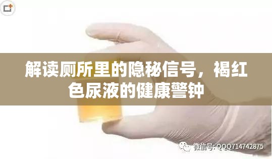 解讀廁所里的隱秘信號，褐紅色尿液的健康警鐘